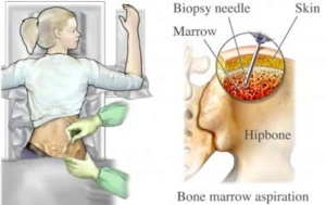 Bone marrow
